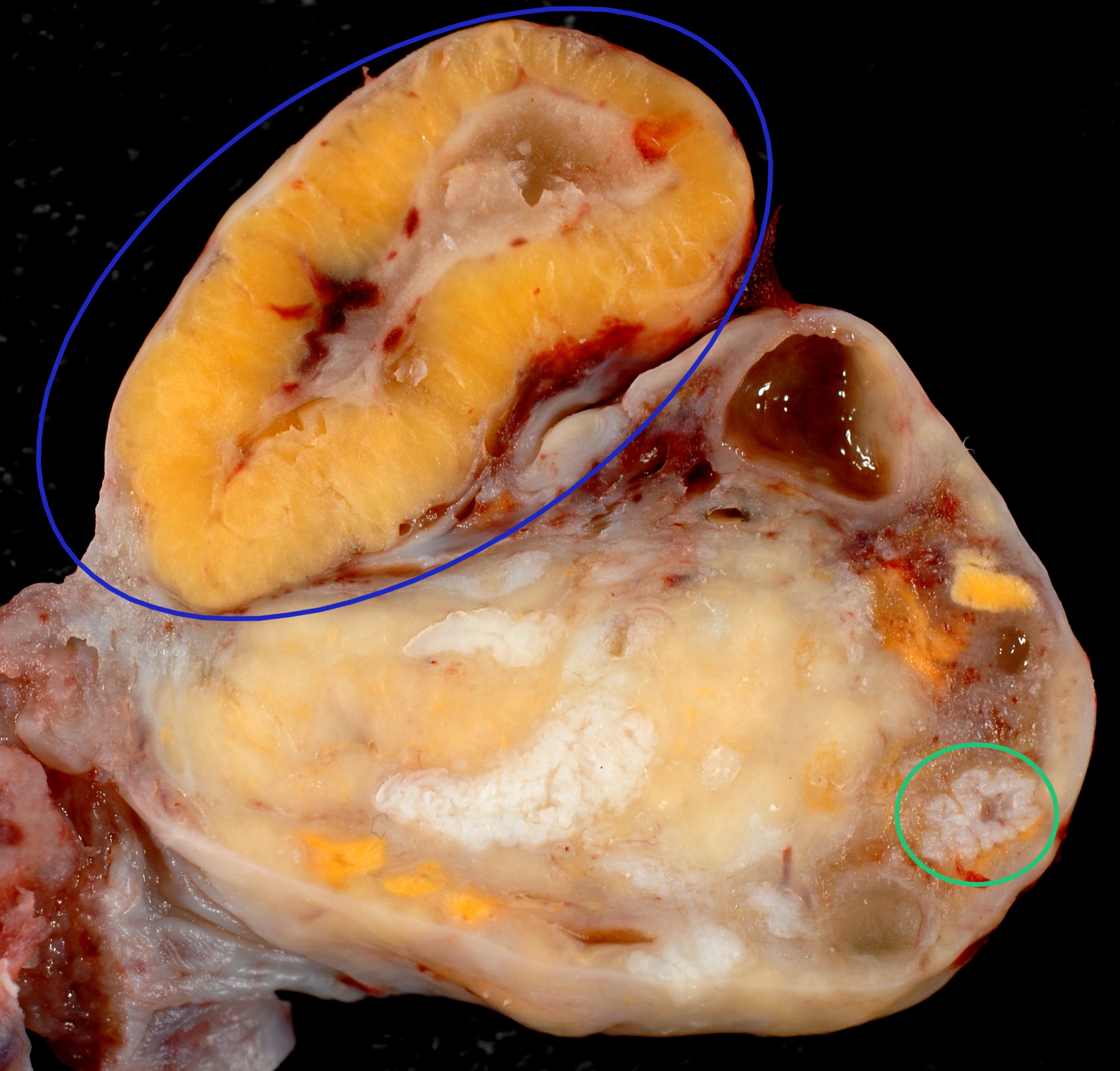 Yellow body in human ovary - click to enlarge