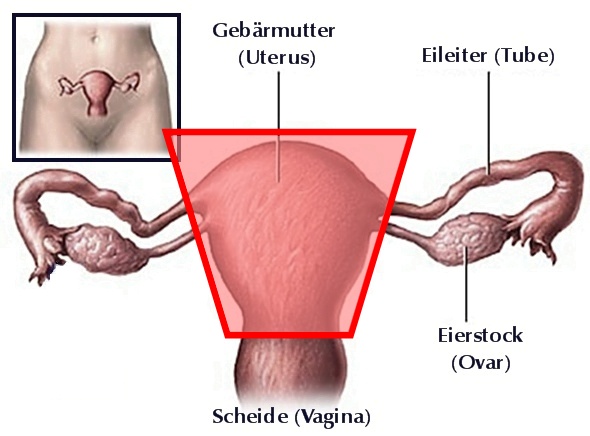 Hysterektomie beckenbodentraining nach Gebärmutterentfernung (Hysterektomie)